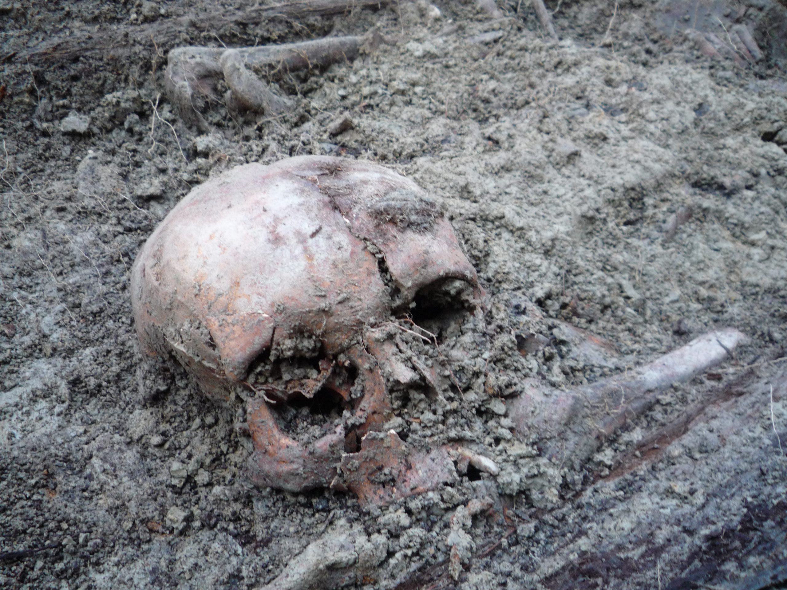 Skull from the mass grave